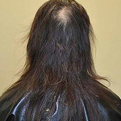 Before image 1
