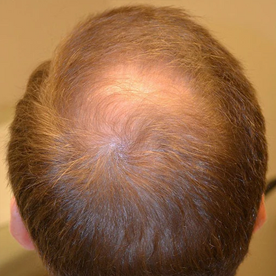 Before image 2