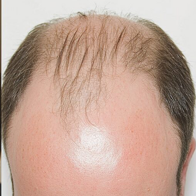 Before image 3